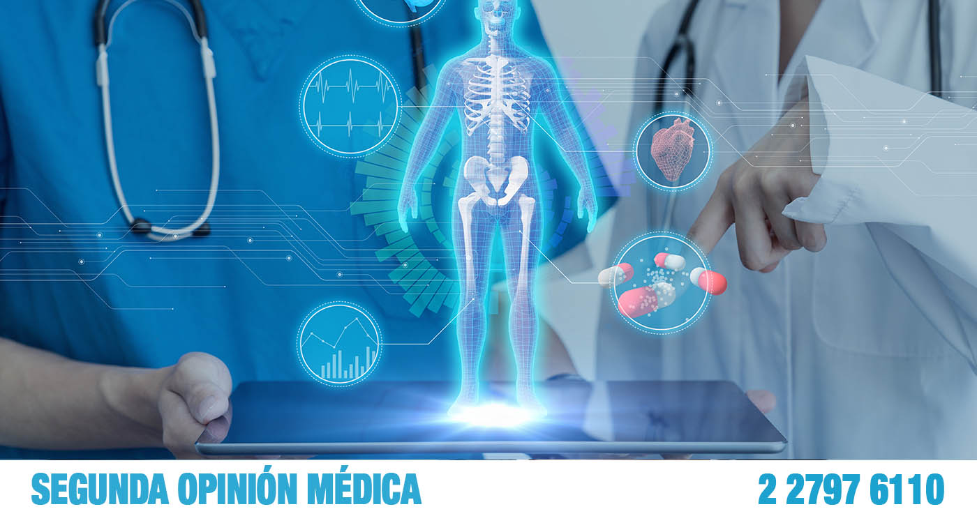 SegundaOpinio_n.jpg